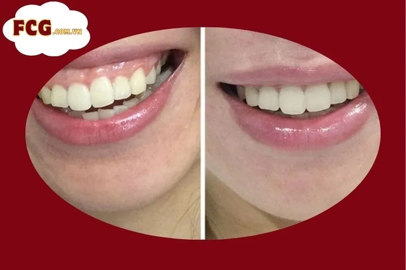 Viện thẩm mỹ Hùng Vương